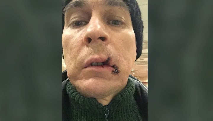Оперный певец порвал рот во время спектакля в Екатеринбурге
