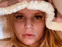 Известная голливудская актриса молит о помощи: в Сеть попали фото ее опухшей ноги