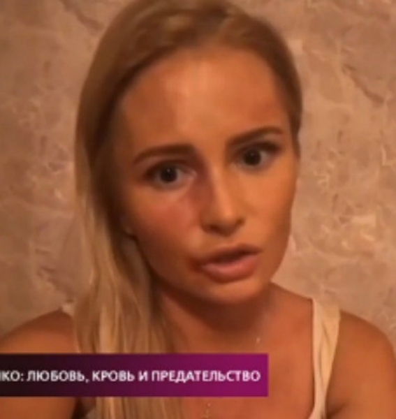 Дана Борисова пожаловалась на побои со стороны Данко