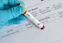 Для чего нужен анализ на ПСА