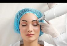 Особенности удаления татуажа лазером