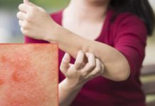 Как обрабатывать вещи при чесотке?