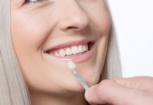 Что такое виниры?