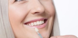 Что такое виниры?