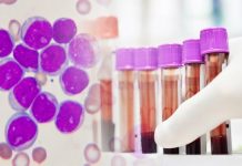 Лечение лейкоза в Израиле