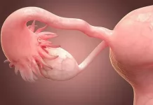 Хронический и острый аднексит: самые эффективные способы лечения