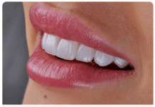 Имплантация зубов: всё, что нужно знать