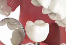 Имплантация зубов: современное решение для здоровой и красивой улыбки